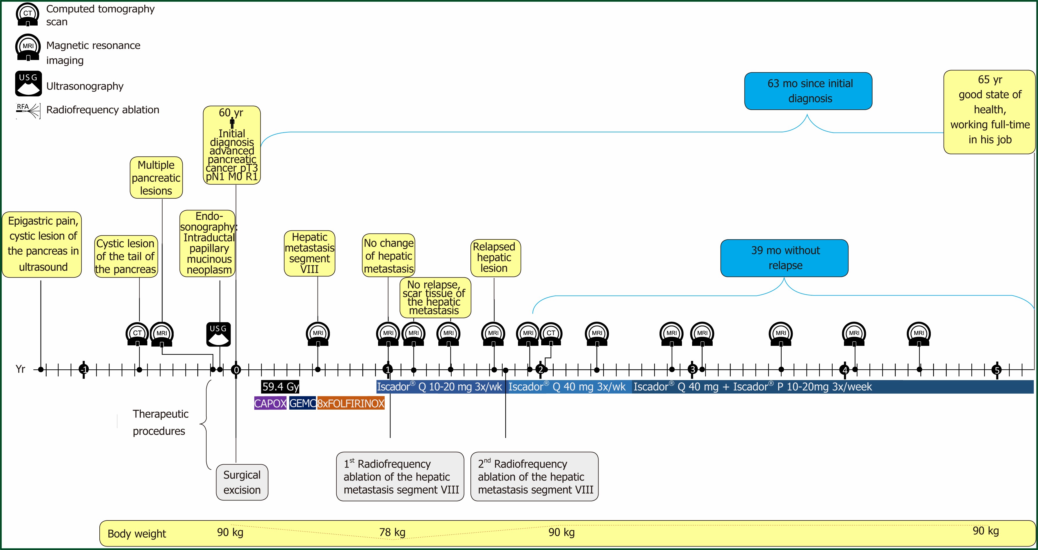 stage-4-pancreatic-cancer-hospice-timeline-timeline-resume-template